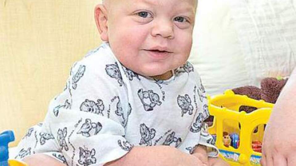 MPS nedir? Nasıl bir hastalıktır?