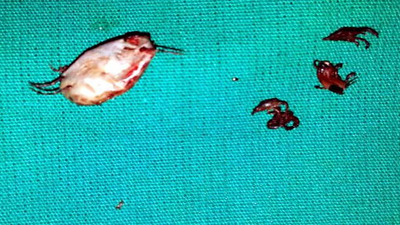 84 yaşındaki çiftçinin kulağından 7 kene çıkarıldı