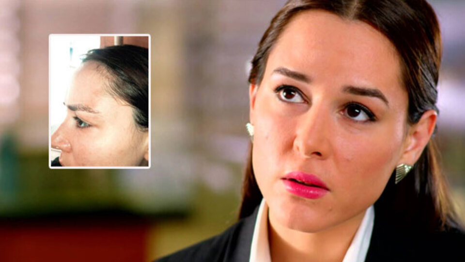 'Ayrılalım dedim kafamda telefon parçaladı'