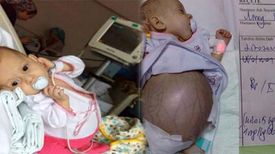 Ölüme 10 gün kala mucize!