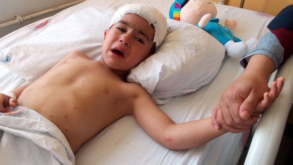 Kampüste dehşet: Kafa derisini ısırdılar