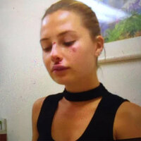 Serdar Ortaç'ın eşi bu hale geldi!