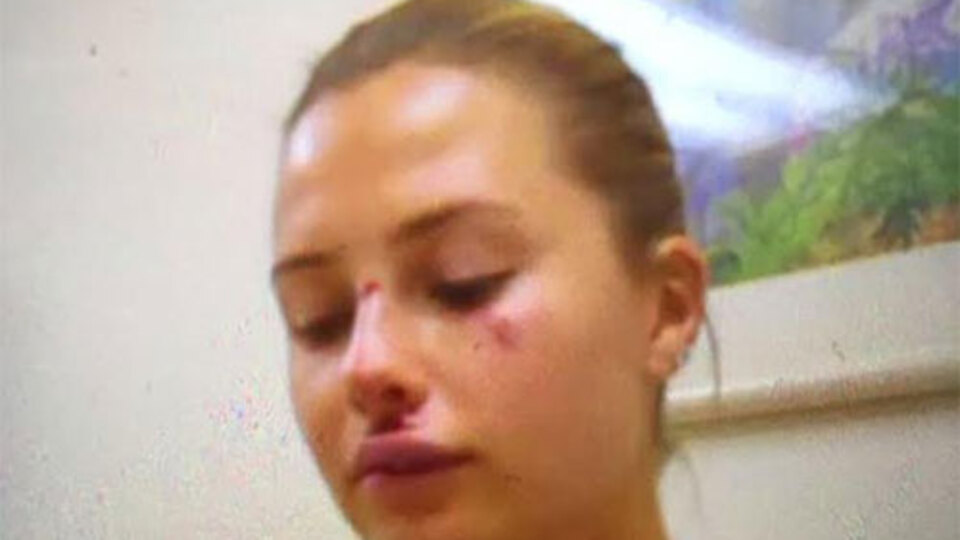 Serdar Ortaç'ın eşi bu hale geldi!