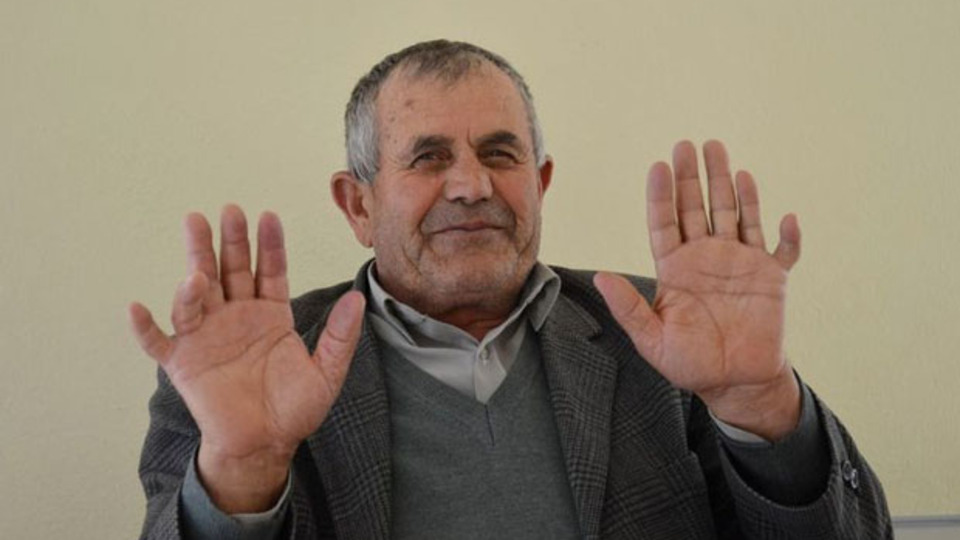 24 parmağıyla herkesi şaşırtıyor