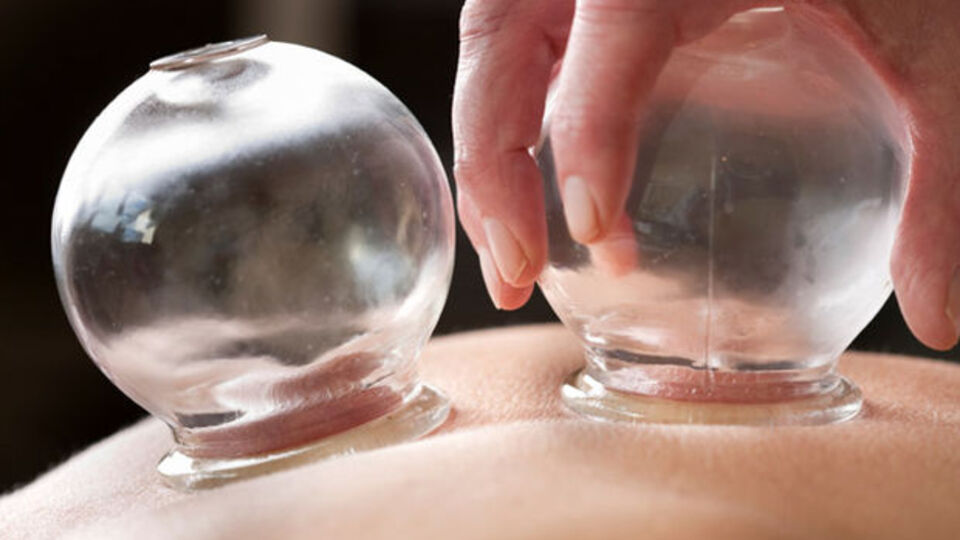 İşte hacamatın yararları