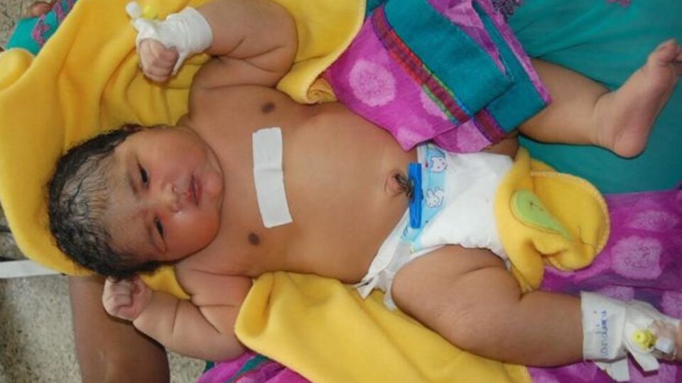 Tam 6,8 kilo doğdu!