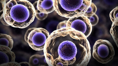 Gençlerde kanser ölümleri endişe verici boyutta