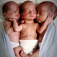 Üçü de birbirinin aynısı! 200 milyonda bir görülüyor!