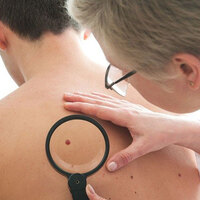 Cilt kanserinde devrim!