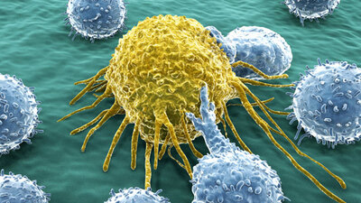 Altı yaşındaki çocuğa prostat kanseri teşhisi!