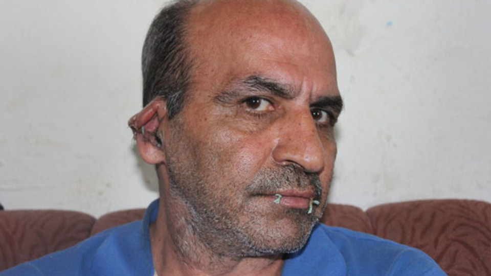 BM'yi protesto için ağzını ve kulaklarını dikti!