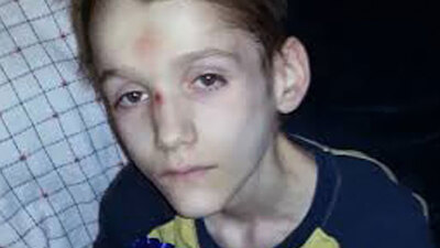 Açlıktan ve hastalıktan öldü!