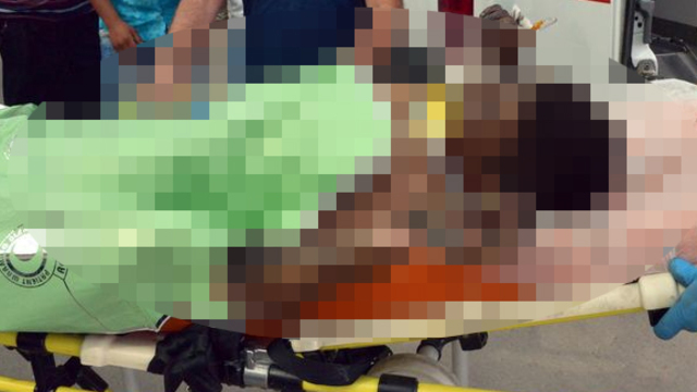 Atık yağ varili patladı! 13 yaşındaki çırak ağır yaralı