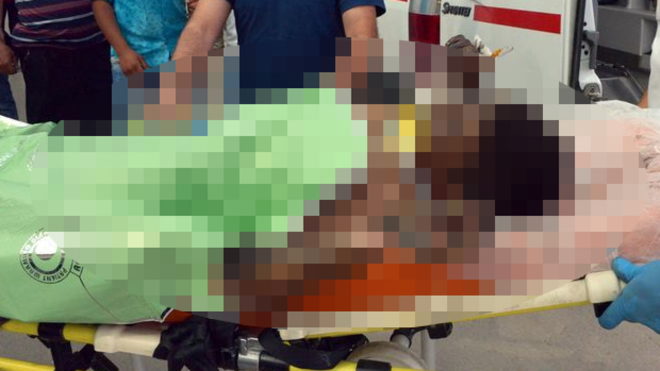 Atık yağ varili patladı! 13 yaşındaki çırak ağır yaralı