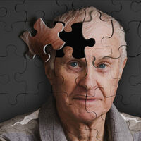 Alzheimer'dan böyle korunun!