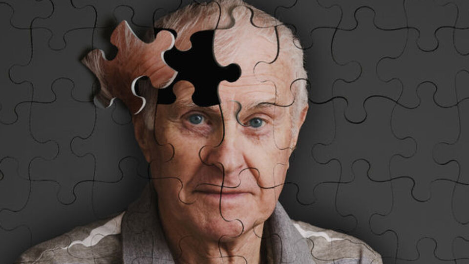 Alzheimer'dan böyle korunun!