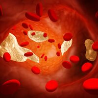 Kolesterol kalp hastalığına yol açar mı?