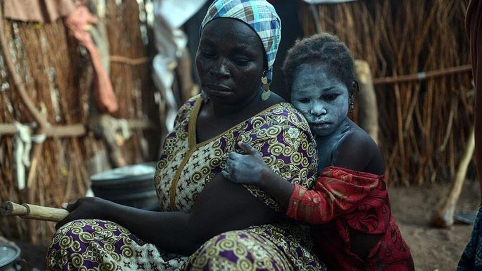 O ülkede 200 kişi açlıktan öldü