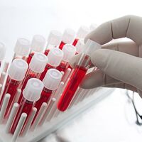 Kandan kanser teşhisi!