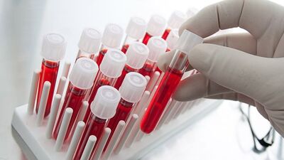 Kandan kanser teşhisi!