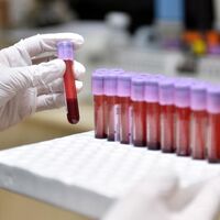 Evlenmeden önce buna dikkat!