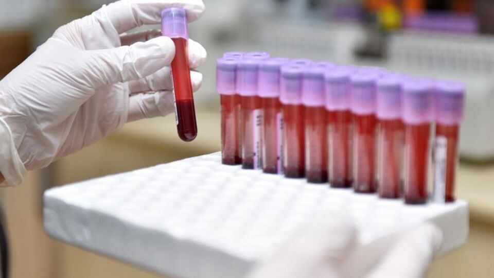 Evlenmeden önce buna dikkat!