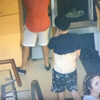 Hastaneden sonra ilk işi! Belinde korseyle gitti