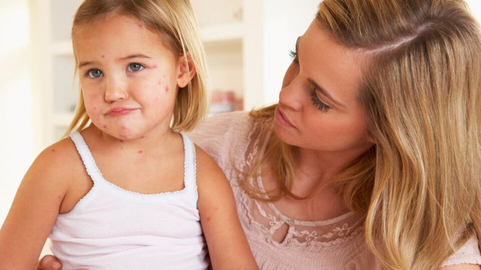 İşte çocukları tehdit eden yaz hastalıkları!