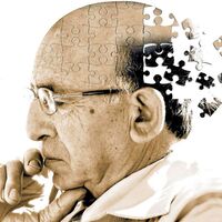 Alzheimer için yeni göz testi!