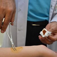 Yaz aylarında Kırım Kongo'ya dikkat!