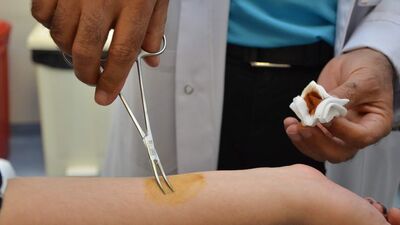 Yaz aylarında Kırım Kongo'ya dikkat!