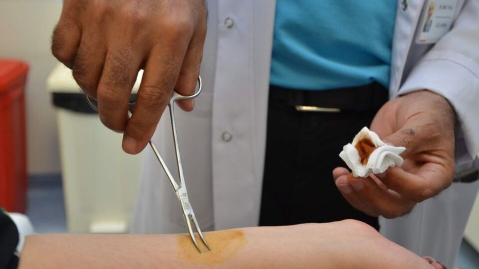 Yaz aylarında Kırım Kongo'ya dikkat!