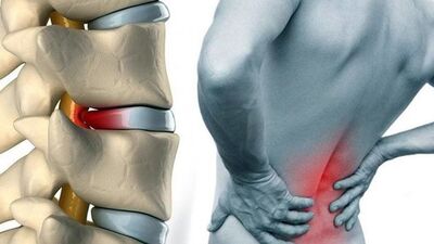 Bel ve boyun ağrılarını önlemenin yolları!