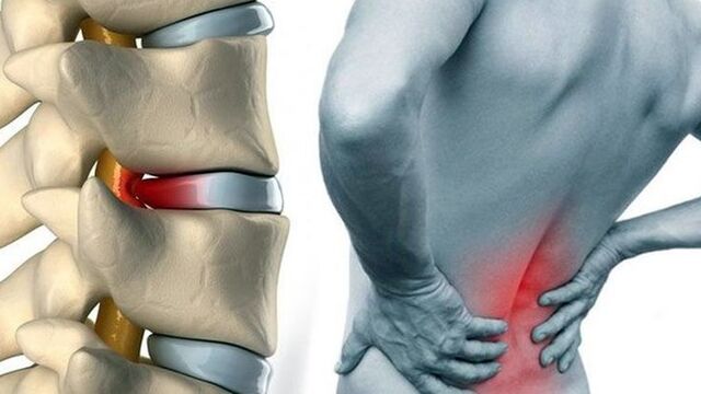 Bel ve boyun ağrılarını önlemenin yolları!