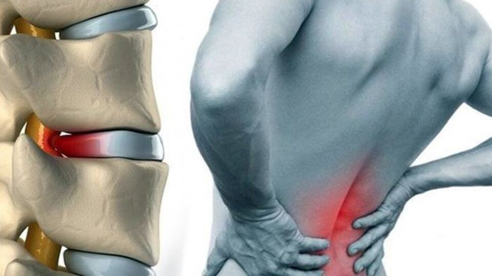 Bel ve boyun ağrılarını önlemenin yolları!