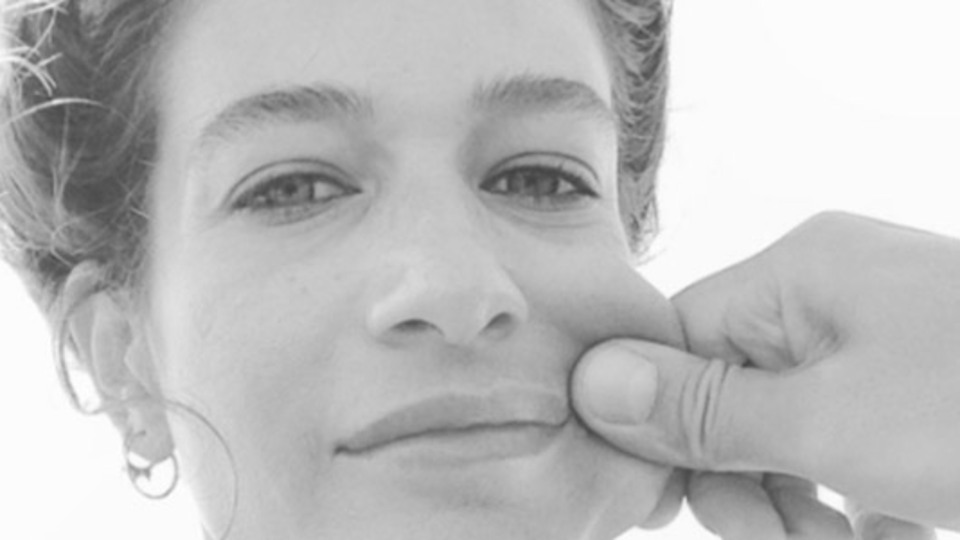 Yanaktan makas aldırdı