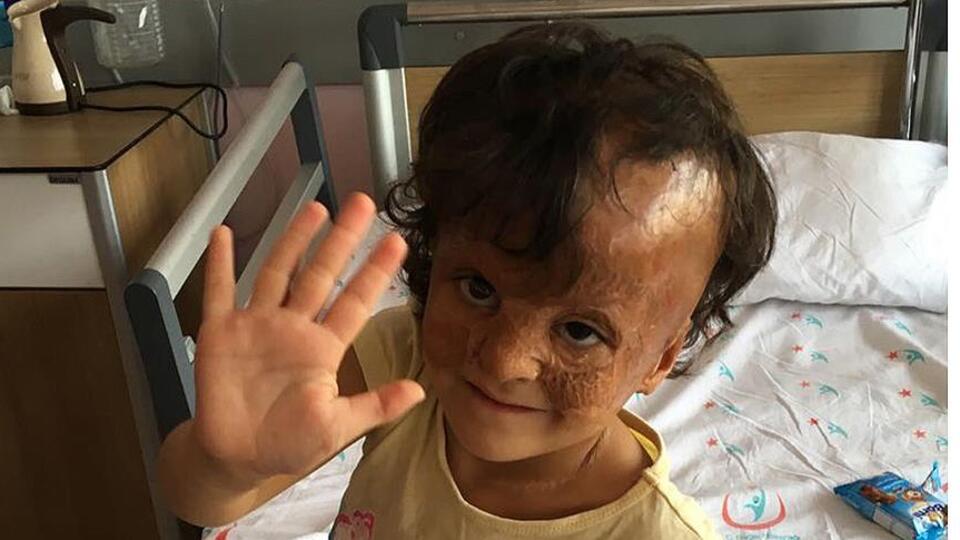 Suriyeli Fatma'nın 'yüzü' gülecek!