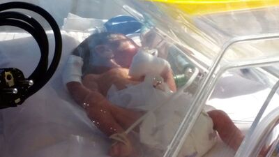 7 aylık doğan ve yemek borusu gelişmeyen bebek Ankara'ya sevk edildi!