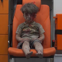 "Çocuğunu böyle görmek çok acı verici"