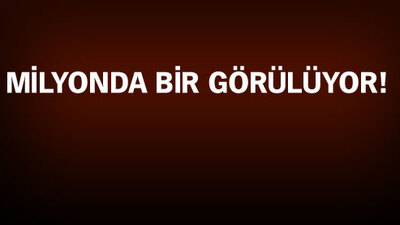 O şehirde yılan bebek dünyaya geldi!