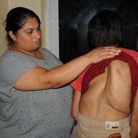 Omurga eğriliği olan genç kız yardım bekliyor