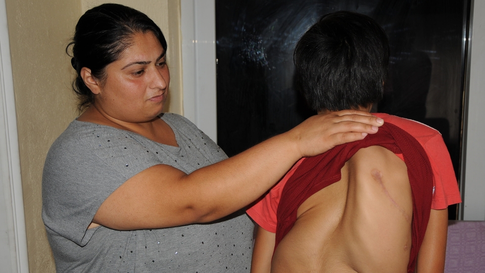 Omurga eğriliği olan genç kız yardım bekliyor