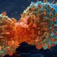 ‘Aşırı kilonun 8 kanser türüyle bağlantısı var’