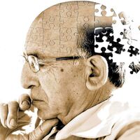 Alzheimer tedavisinde yeni umut ışığı