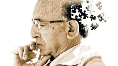 Alzheimer tedavisinde yeni umut ışığı