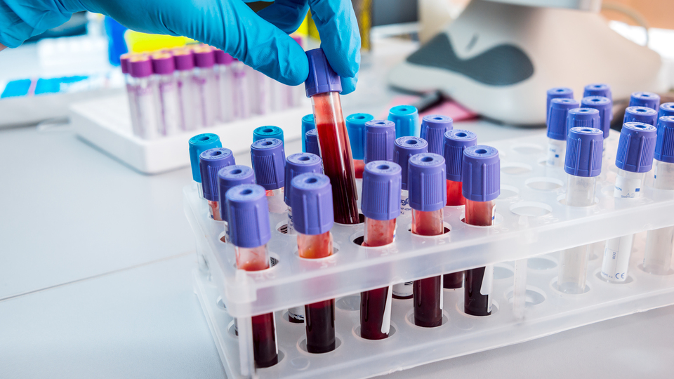 Tek bir belirti yokken kanseri anlayan test!