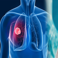 Kanserliyi ilaçlar mı öldürüyor?