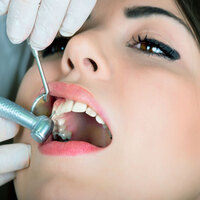 Ağızdaki tehlike: Dolgu sayısı bu rakamı geçerse...