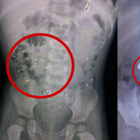 Yer: İzmir! Doktorları şoke eden çocuk!