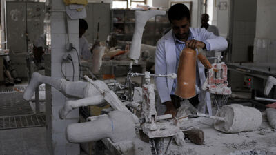 Türkiye'den Yemen'e protez merkezi